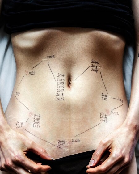 Bafta winner this is endometriosis film 1