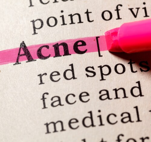 My Long-Term Relationship with Acne by Bhaavya Goenka